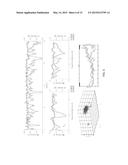 SYSTEM AND METHOD FOR RISK STRATIFICATION BASED ON DYNAMIC  NONLINEAR     ANALYSIS AND COMPARISON OF CARDIAC REPOLARIZATION WITH OTHER     PHYSIOLOGICAL SIGNALS diagram and image