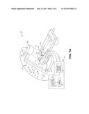 METHOD AND SYSTEM TO ASSESS MECHANICAL DYSSYNCHRONY BASED ON MOTION DATA     COLLECTED BY A NAVIGATION SYSTEM diagram and image