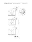 METHOD AND SYSTEM TO ASSESS MECHANICAL DYSSYNCHRONY BASED ON MOTION DATA     COLLECTED BY A NAVIGATION SYSTEM diagram and image