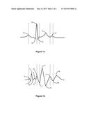 METHOD AND APPARATUS FOR DETERMINING INFORMATION INDICATIVE OF CARDIAC     MALFUNCTIONS AND ABNORMALITIES diagram and image