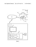 METHOD AND APPARATUS FOR DETERMINING INFORMATION INDICATIVE OF CARDIAC     MALFUNCTIONS AND ABNORMALITIES diagram and image