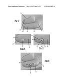 TREATMENT METHOD FOR THE INFERIOR TURBINATE diagram and image