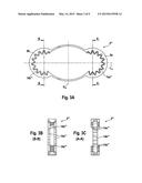 FIXING DEVICE FOR FIXING THE FRACTURE ENDS OF THE BONES IN A BONE     FRACTURE, AND TENSIONING ELEMENT, ANGLE CLAMPING SLEEVE AND CORRESPONDING     METHOD diagram and image