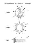 FIXING DEVICE FOR FIXING THE FRACTURE ENDS OF THE BONES IN A BONE     FRACTURE, AND TENSIONING ELEMENT, ANGLE CLAMPING SLEEVE AND CORRESPONDING     METHOD diagram and image