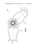 FIXING DEVICE FOR FIXING THE FRACTURE ENDS OF THE BONES IN A BONE     FRACTURE, AND TENSIONING ELEMENT, ANGLE CLAMPING SLEEVE AND CORRESPONDING     METHOD diagram and image