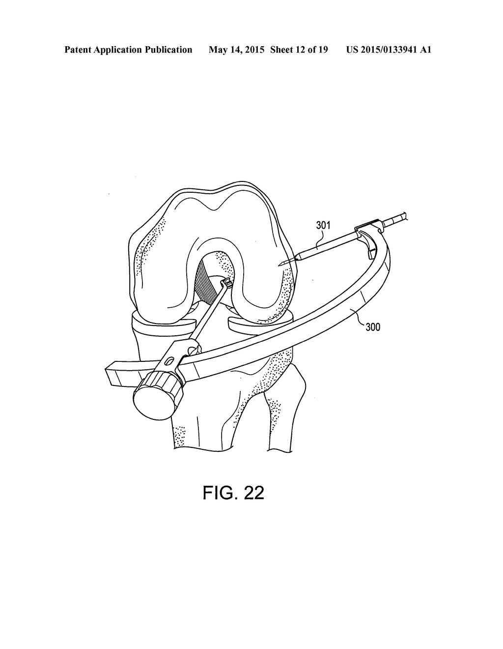 DRILL PIN FOR FIXATION OF LIGAMENTS USING BUTTON/LOOP CONSTRUCT - diagram, schematic, and image 13