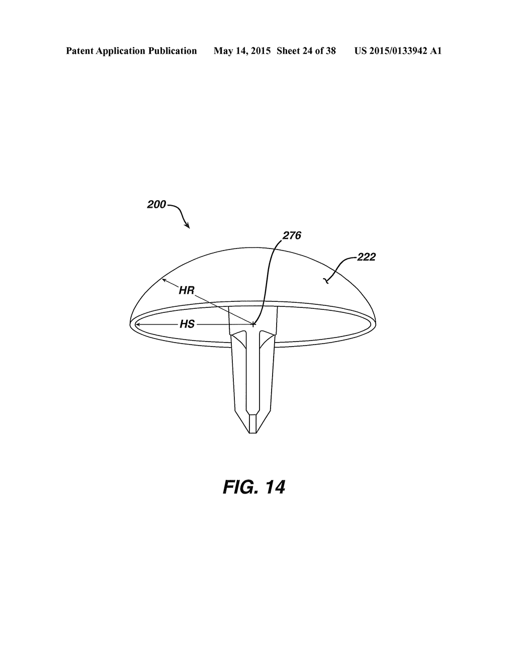 Arthroplasty Instruments and Associated Method - diagram, schematic, and image 25