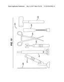 Arthroplasty Instruments and Associated Method diagram and image