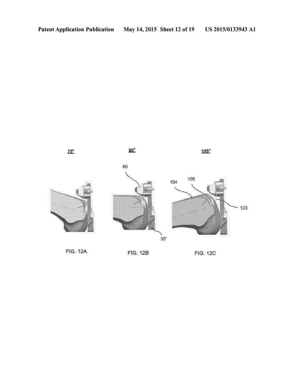 RESECTION GUIDE AND METHOD OF POSITIONING - diagram, schematic, and image 13