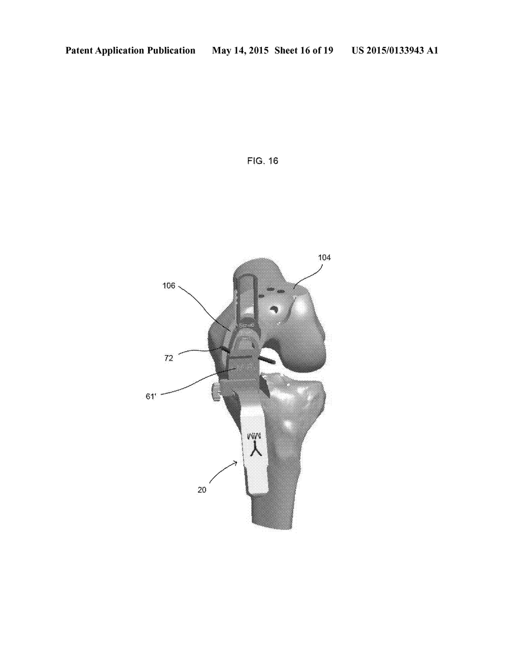 RESECTION GUIDE AND METHOD OF POSITIONING - diagram, schematic, and image 17