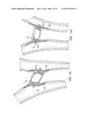 MULTI-LAYER BRAIDED STRUCTURES FOR OCCLUDING VASCULAR DEFECTS diagram and image