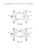 MULTI-LAYER BRAIDED STRUCTURES FOR OCCLUDING VASCULAR DEFECTS diagram and image