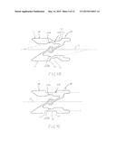 BONE TREATMENT IMPLANTS, AND SPRINGS THEREFORE diagram and image