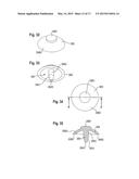 BONE ANCHOR AND BONE ANCHORING ASSEMBLY COMPRISING THE SAME diagram and image