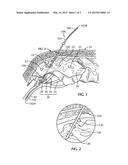 IMPLANTABLE MEDICAL LEAD FOR STIMULATION OF MULTIPLE NERVES diagram and image