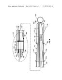 CATHETER DELIVERABLE ARTIFICIAL MULTI-LEAFLET HEART VALVE PROSTHESIS AND     INTRAVASCULAR DELIVERY SYSTEM FOR A CATHETER DELIVERABLE HEART VALVE     PROSTHESIS diagram and image