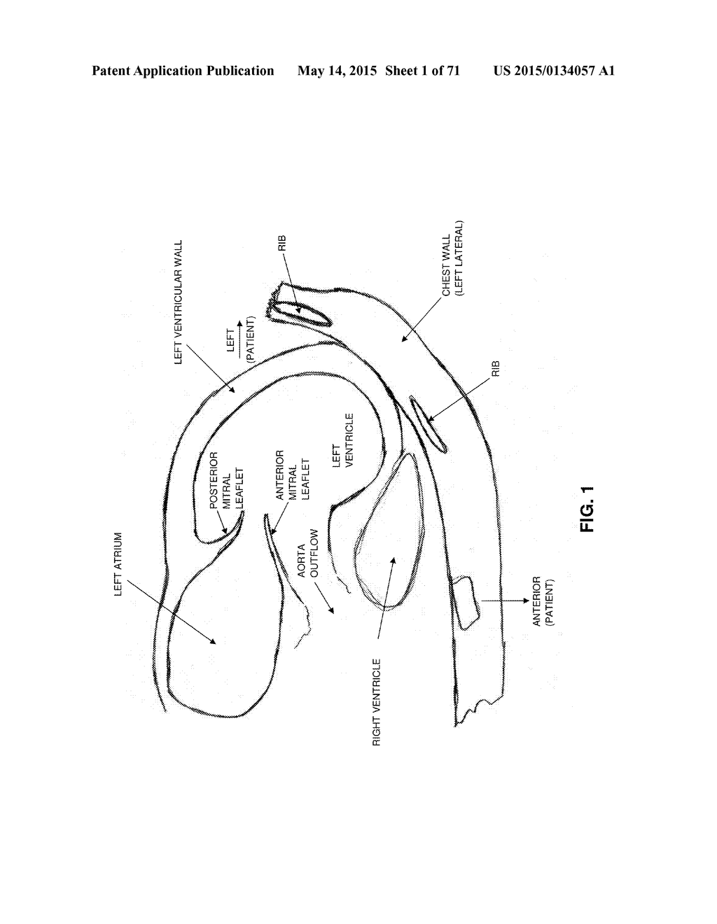 METHOD AND APPARATUS FOR REPAIRING A MITRAL VALVE - diagram, schematic, and image 02