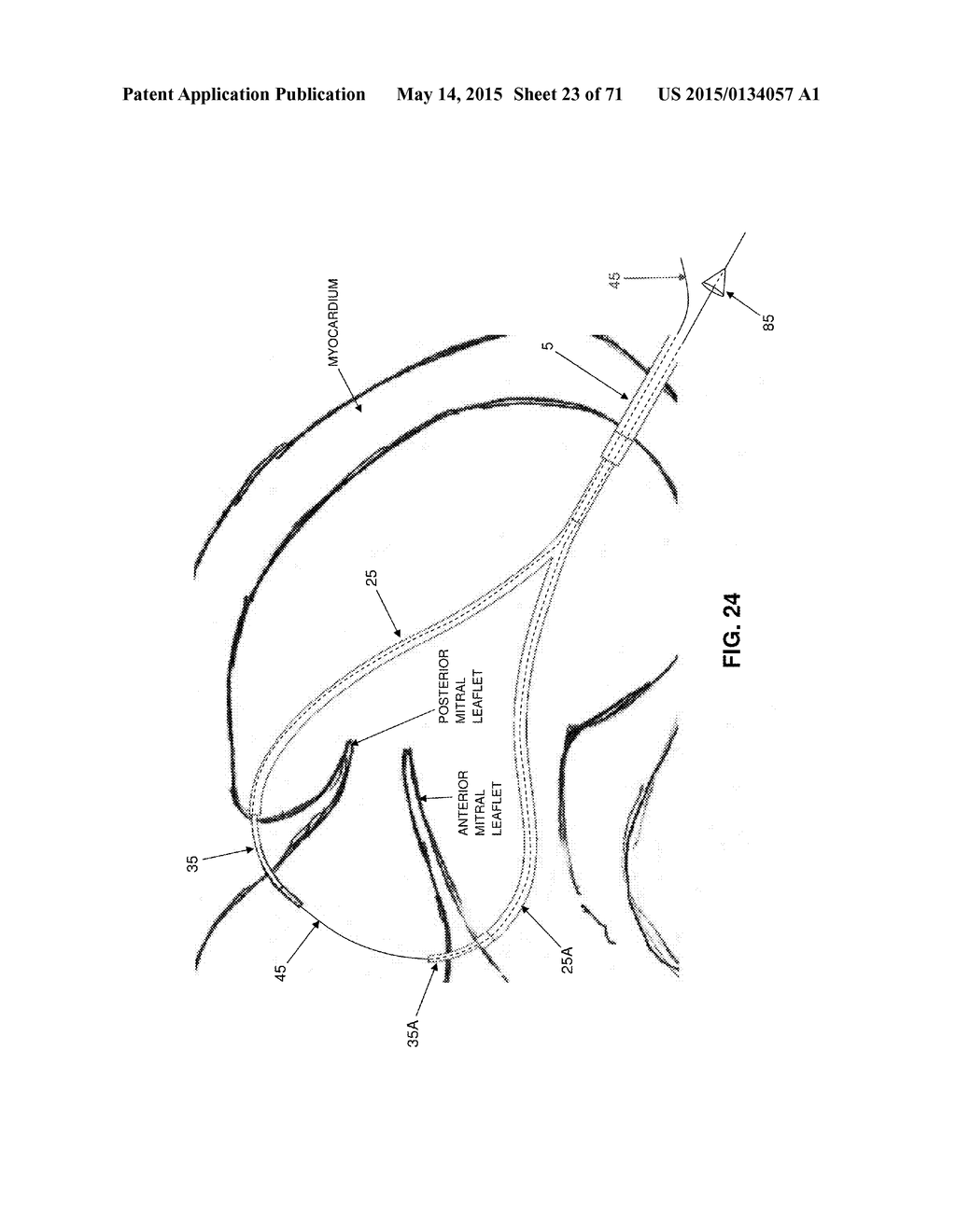 METHOD AND APPARATUS FOR REPAIRING A MITRAL VALVE - diagram, schematic, and image 24