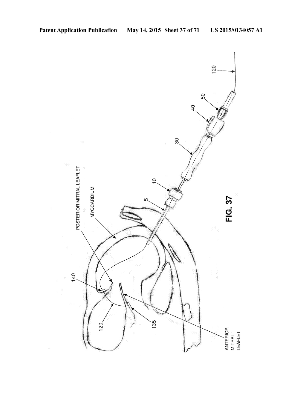 METHOD AND APPARATUS FOR REPAIRING A MITRAL VALVE - diagram, schematic, and image 38