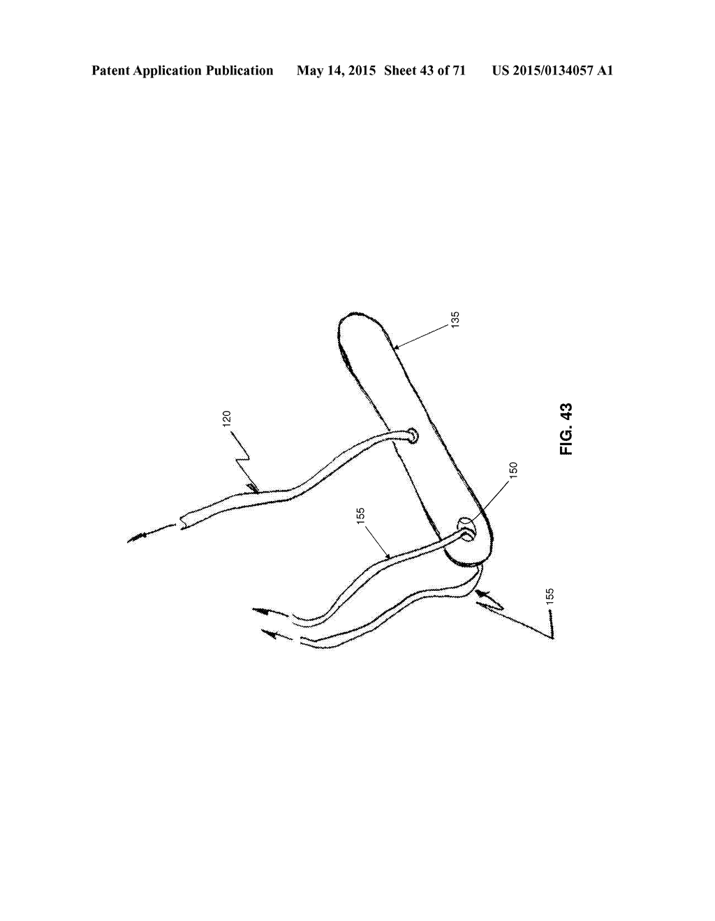 METHOD AND APPARATUS FOR REPAIRING A MITRAL VALVE - diagram, schematic, and image 44