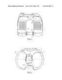 ARTIFICIAL KNEE JOINT diagram and image