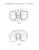 ARTIFICIAL KNEE JOINT diagram and image