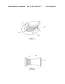 ARTIFICIAL KNEE JOINT diagram and image