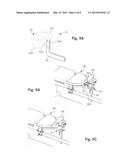 Modular Operating Table diagram and image