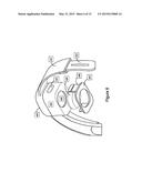 SYSTEMS AND DEVICES FOR COUPLING ULTRASOUND ENERGY TO A BODY diagram and image