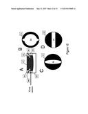 SYSTEMS AND DEVICES FOR COUPLING ULTRASOUND ENERGY TO A BODY diagram and image