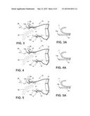 FLUSH AND SUB-FLUSH PROTECTIVE SHIELDS TO REDUCE EXHAUST SOOT AND     CONDENSATE DEPOSITION diagram and image