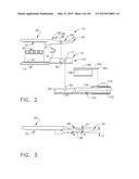 SURGICAL STAPLER WITH FLOATING ANVIL diagram and image