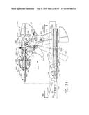 SURGICAL STAPLER WITH FLOATING ANVIL diagram and image