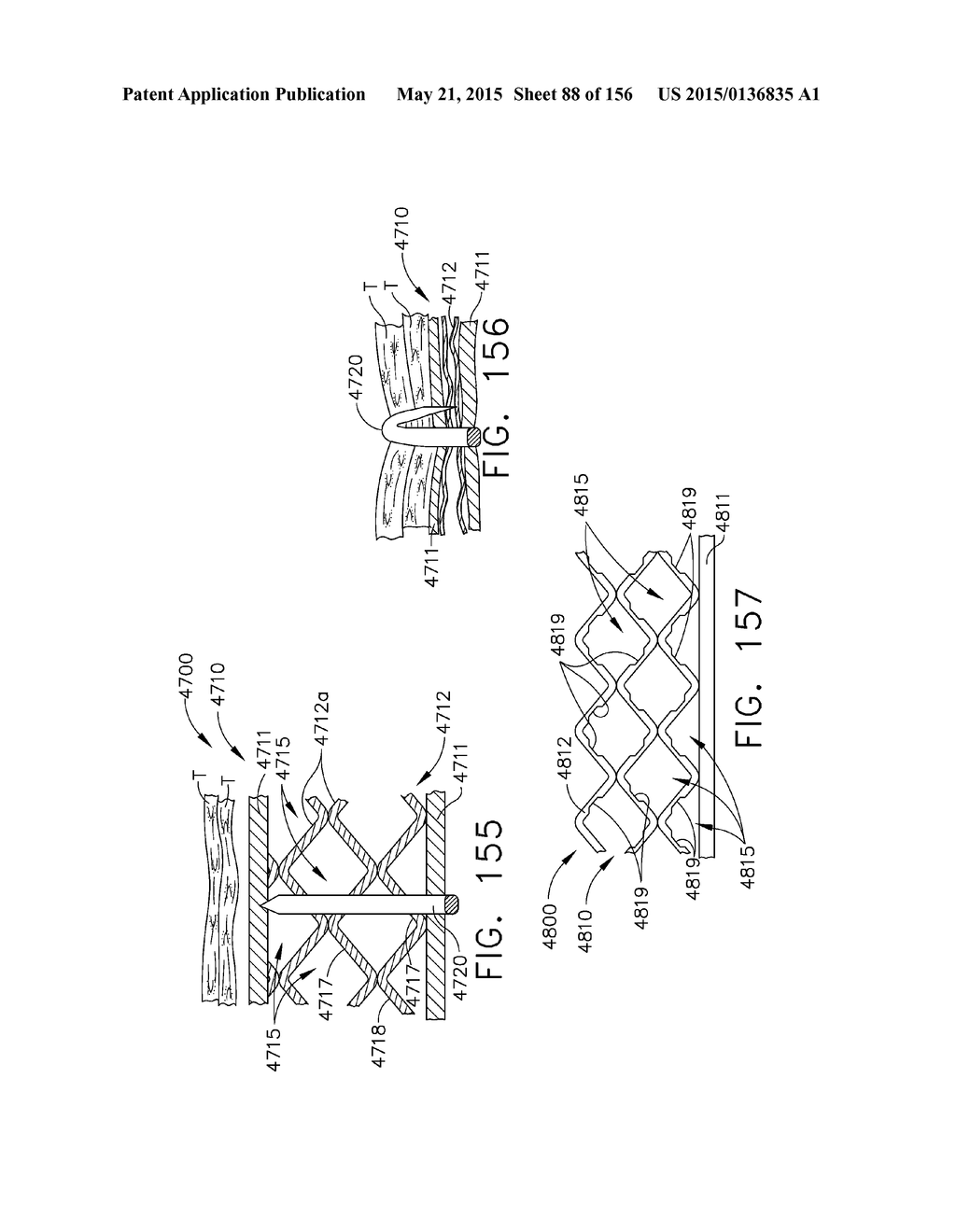 SURGICAL STAPLER WITH FLOATING ANVIL - diagram, schematic, and image 89