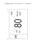 Graphical Display of Physiological Parameters on Patient Monitors diagram and image