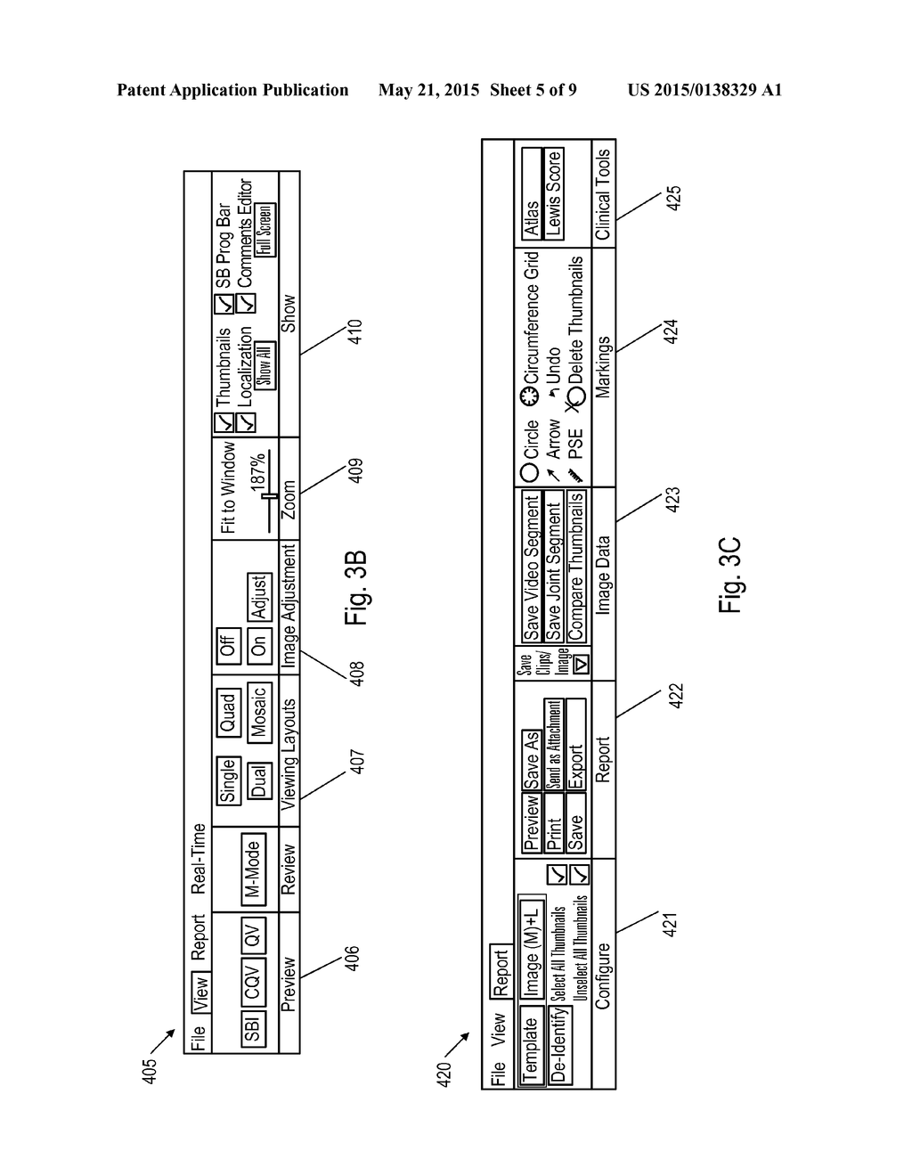 SYSTEM AND METHOD FOR AUTOMATIC NAVIGATION OF A CAPSULE BASED ON IMAGE     STREAM CAPTURED IN-VIVO - diagram, schematic, and image 06