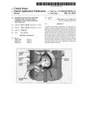 METHOD AND SYSTEM TO MEASURE TEMPERATURE OF GASES USING COHERENT     ANTI-STOKES DOPPLER SPECTROSCOPY diagram and image