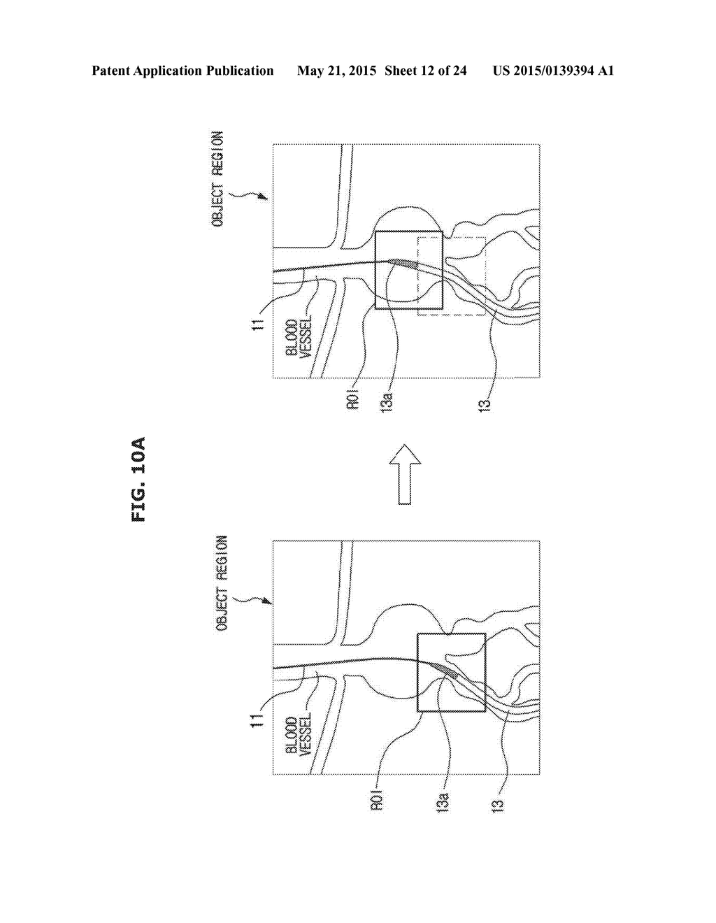 X-RAY IMAGING APPARATUS AND METHOD OF CONTROLLING THE SAME - diagram, schematic, and image 13