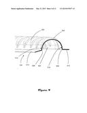 SUSPENSION FOR ACOUSTIC DEVICE diagram and image