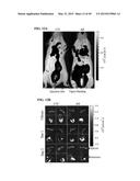 MICROSPHERE-BASED DELIVERY AND EX VIVO MANIPULATION OF DENDRITIC CELLS FOR     AUTOIMMUNE THERAPIES diagram and image