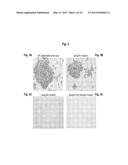 INTERACTION OF MORAXELLA CATARRHALIS WITH EPITHELIAL CELLS, EXTRACELLULAR     MATRIX PROTEINS AND THE COMPLEMENT SYSTEM diagram and image