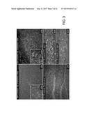 METHOD FOR DETECTING INJURY TO THE BRAIN diagram and image