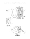DENTAL RETRACTOR FOR PROTECTING A PATIENT S TEETH FROM CONTACT WITH THE     INNER SIDE OF A PATIENT S MOUTH AND TONGUE diagram and image