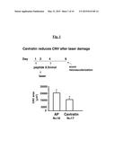 METHOD OF TREATING AND PREVENTING OCULAR ANGIOGENESIS diagram and image