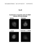 METHOD OF TREATING AND PREVENTING OCULAR ANGIOGENESIS diagram and image