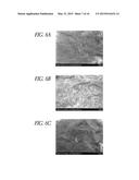 METHODS FOR ISOLATION OF BIOMARKERS FROM VESICLES diagram and image