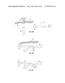 APPARATUS AND METHOD FOR INTRA-ABDOMINALLY MOVING A FIRST INTERNAL ORGAN     TO A POSITION AWAY FROM A SECOND INTERNAL ORGAN AND THEN HOLDING THE     FIRST INTERNAL ORGAN IN THE POSITION WITHOUT MANUAL INPUT diagram and image