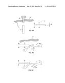 APPARATUS AND METHOD FOR INTRA-ABDOMINALLY MOVING A FIRST INTERNAL ORGAN     TO A POSITION AWAY FROM A SECOND INTERNAL ORGAN AND THEN HOLDING THE     FIRST INTERNAL ORGAN IN THE POSITION WITHOUT MANUAL INPUT diagram and image