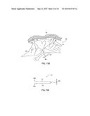 APPARATUS AND METHOD FOR INTRA-ABDOMINALLY MOVING A FIRST INTERNAL ORGAN     TO A POSITION AWAY FROM A SECOND INTERNAL ORGAN AND THEN HOLDING THE     FIRST INTERNAL ORGAN IN THE POSITION WITHOUT MANUAL INPUT diagram and image