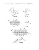 APPARATUS AND METHOD FOR INTRA-ABDOMINALLY MOVING A FIRST INTERNAL ORGAN     TO A POSITION AWAY FROM A SECOND INTERNAL ORGAN AND THEN HOLDING THE     FIRST INTERNAL ORGAN IN THE POSITION WITHOUT MANUAL INPUT diagram and image